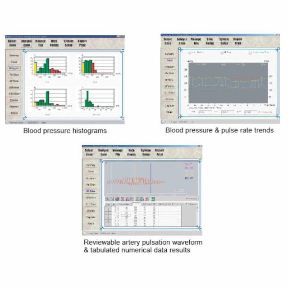 Λογισμικό για holter πίεσης iH-B Biocare