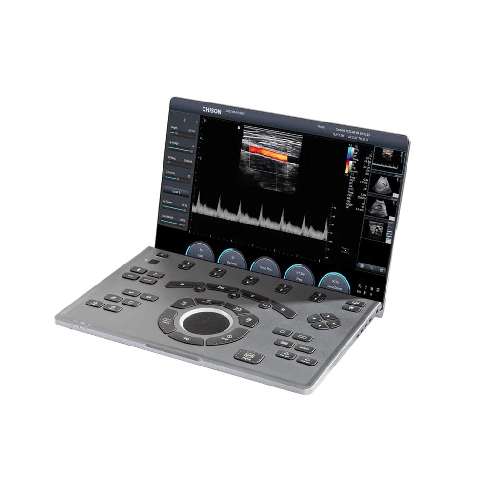 Έγχρωμος Υπέρηχος φορητός CHISON Sonoair 30